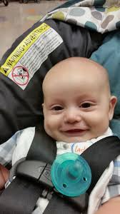 From Guts to Glory: Kain's Journey with Gastroschisis