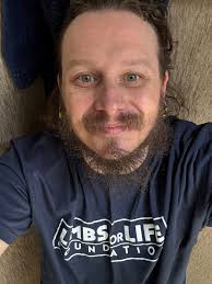 Urgent blood donation needed for leg amputation surgery