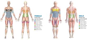 Superficial back muscles, intermediate back muscles and intrinsic back muscles.the intrinsic muscles are named as such because their embryological development begins in the back, oppose to the superficial and intermediate back muscles which develop elsewhere and are therefore classed as extrinsic muscles. Cryolipolysis