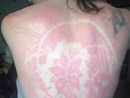 The results are too preliminary to suggest that tattoos can increase the risk for cancer, say the authors. Teenagers Are Increasing Their Chances Of Cancer With Sunburn Art Tattoos Doctors Say The Independent The Independent