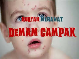 Demam campak bayi adalah masalah biasa yang berlaku. Ruqyah Efektif Merawat Demam Campak Powerful Ruqyah To Heal Chickenpox Youtube