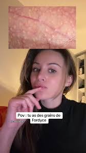 Josh Fordyce's Instagram, Twitter & Facebook