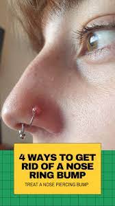 What are the signs of an infected nose piercing? 4 Things To Treat Infected Nose Piercing Bump Without Closing It In 2021 Nose Piercing Bump Piercing Bump Nose Piercing Tips