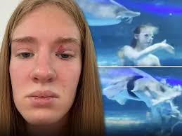 Mermaid Performer Says She Was Rushed to Hospital After Viral Fish Attack