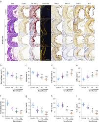 Cocoa collagen power plus contains: Sevoflurane Prevents Vulnerable Plaque Disruption In Apolipoprotein E Knockout Mice By Increasing Collagen Deposition And Inhibiting Inflammation Sciencedirect