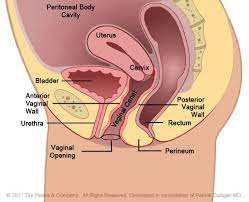 Rectocele Diagram Surgery Female Genital Anatomy Images Peritoneal Body Cavity Uterus Bladder Anterior Wall Urethra Openi Anatomia Anatomia Humana Piso Pelvico