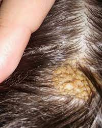 Was Ist Diese Beule Kopf