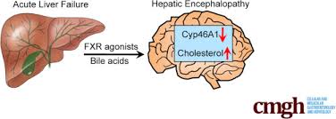 Fxr Mediated Cortical Cholesterol Accumulation Contributes To The Pathogenesis Of Type A Hepatic Encephalopathy Cellular And Molecular Gastroenterology And Hepatology