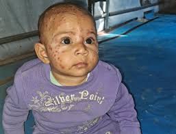 Hope amid the rubble: Help Mahmoud and his family survive and rebuild