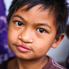 Angeles City, Philippines