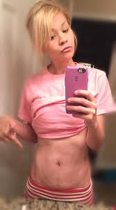 The site owner hides the web page description. You Ve Got To See These Gorgeous Photos Of Moms Owning Their Postpartum Stretch Marks