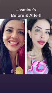 Jasmine Eats Teeth Transformation