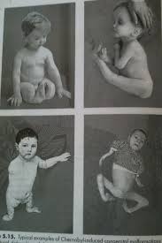Read answers to longstanding questions about the health effects of chernobyl disaster according to the world health organization. Chernobyl You Ve Seen The Tv Series Now Understand The Awful Reality Stuff Co Nz