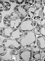 Protoplasts expressing gfp:ebd showed several different patterns of. Vacuoles And Storage Organelles Springerlink