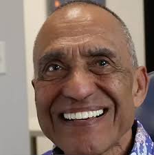 Full Mouth Implants in Houston Texas