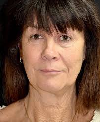 Plastic Surgery Corpus Christi