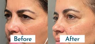 Dr. Megha Vyas January 2025