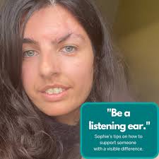 My name is Sophie, and I have a scar through and above my left eyebrow from  a car accident in Australia whilst I was travelling there. "Coming to terms  with having a