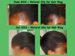 It can also make your hair grow stronger and thicker. Regrow Bald Spots With Jamaican Black Castor Oil Castor Oil For Hair Jamaican Black Castor Oil Hair Growth Castor Oil For Hair Growth