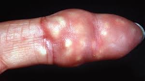 Image result for Oncinotis