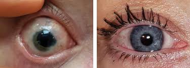 All about brown eye color. Colored Contacts More Than A Pretty Eye
