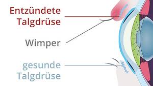 Unsere redaktion an produkttestern unterschiedlichste marken unter die lupe genommen unterstützen und wir zeigen unseren lesern. Gerstenkorn