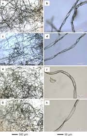 Check spelling or type a new query. Optical Microscope Images Of A B Raw Cotton Fibers And Chemically Download Scientific Diagram