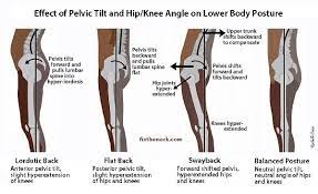 We also discuss the available treatments. A Locked Knee Is Not Secure Embody Movement Pilates Studio
