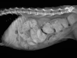 Image result for Megacolon