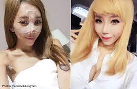 Glojas is not associated to any other clinic or centers in malaysia. Malaysian Dj Leng Yein Unveils New Look After Plastic Surgeries In Korea Health Health News Asiaone