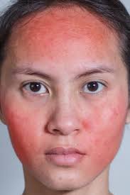 Untuk krim malam manfaat vaseline (petroleum jelly) sangat efektif dan baik untuk dioleskan sebagai krim malam. 9 Produk Vaseline Yang Bisa Membuat Kulit Sehat Berseri