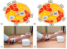The posterior leg muscles that insert on the foot are the: Sensors Free Full Text Myoelectric Signal Classification Of Targeted Muscles Using Dictionary Learning