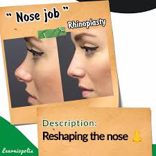 Learn English with Heba Elsahragty (@learniopolis) · Instagram 照片和视频