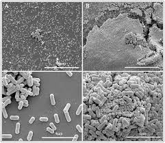 Though in healthy people it doesn't usually cause lasting harm, it threatens pregnant women and. Listeria Monocytogenes Behaviour In Presence Of Non Uv Irradiated Titanium Dioxide Nanoparticles