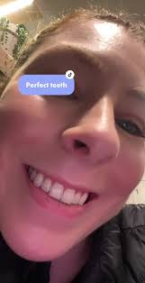 Perfect Teeth: My First Dentist Visit in 4 Years