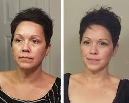 Experiencing sweating during eating and fatigue after?