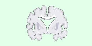 Alzheimer S Disease Nursing Care Plan And Management Nursing Path