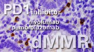 These changes are the result of the interaction between a person's genetic factors and three categories of. Metastatic Colorectal Cancer Patients With A Certain Genetic Mutation Respond Well To Immunotherapy Md Anderson Cancer Center