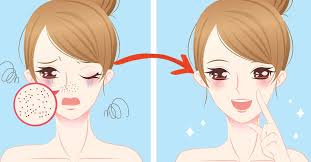 Genialer Trick So Einfach Wirst Du Mitesser Auf Der Nase Los Mitesser Hausmittel Gegen Mitesser Mitesser Entfernen Hausmittel