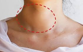 Nódulo na Tireoide: O que significa, sintomas e tipos – Eco Saúde