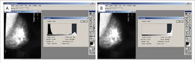 We did not find results for: A Use Of The Lasso Tool In Adobe Photoshop Software On A Mammogram Download Scientific Diagram