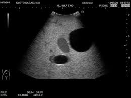 Maybe you would like to learn more about one of these? Us 10 Female Pelvic Ultrasound Phantom Mediscientific