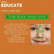 Pin On Nose Bleed Bleeding Blood Clots
