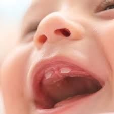 1.3 durchfall beim baby durch zahnen. Ravensburger Family Friends Baby Zahnt Tipps Und Tricks