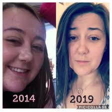 How Rebecca Parrott's Face Changed After Weight Loss