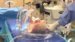 A Day In The Life Of A Perfusionist @ Uhn - Youtube