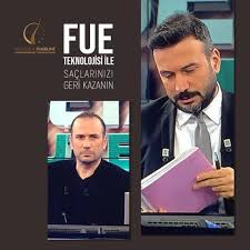 Ertem Sener Sac Ekiminde Turkiye Nin Dunyaya Acilan Facebook