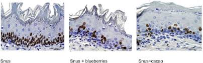 Blood loss can cause blood to collect apply a cool compress to the area as soon as possible to reduce swelling. Factors Effecting The Induction Of Rat Forestomach Hyperplasia Induced By Swedish Oral Smokeless Tobacco Snus Sciencedirect