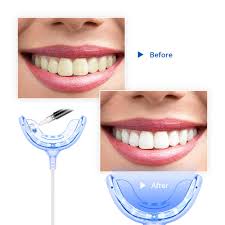 Teeth Whitening Led Light Portable Smart Timing Home Using Cold Blue Light Trays Device Dental Equipment For Android Ios Type C Aliexpress