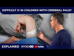 Image result for Difficult Intravenous Access in Children